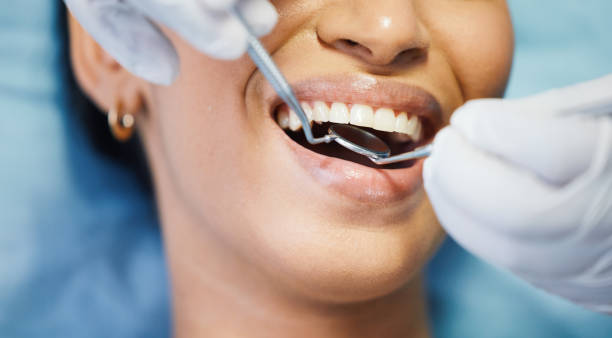 Best Broken or Chipped Tooth Repair in Coalgate, OK