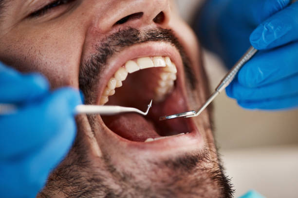 Best Emergency Root Canal Therapy in Coalgate, OK